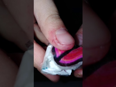 Squishy sammlung teil 2❤️☺️lustiges video